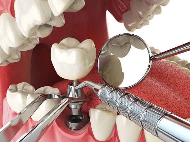 Best Broken or Cracked Tooth Emergency Dentist in Brownsville, PA